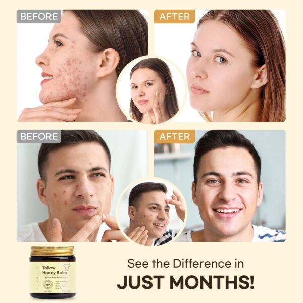 Beef Tallow Skincare 03